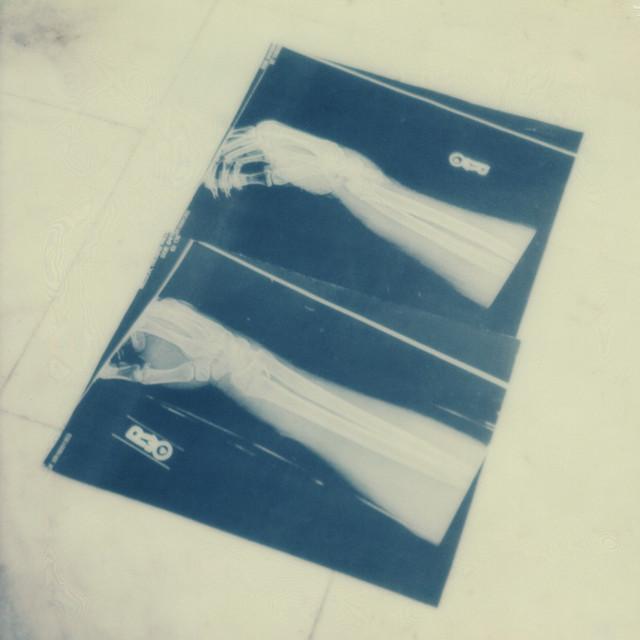 Radial - Benoît Pioulard