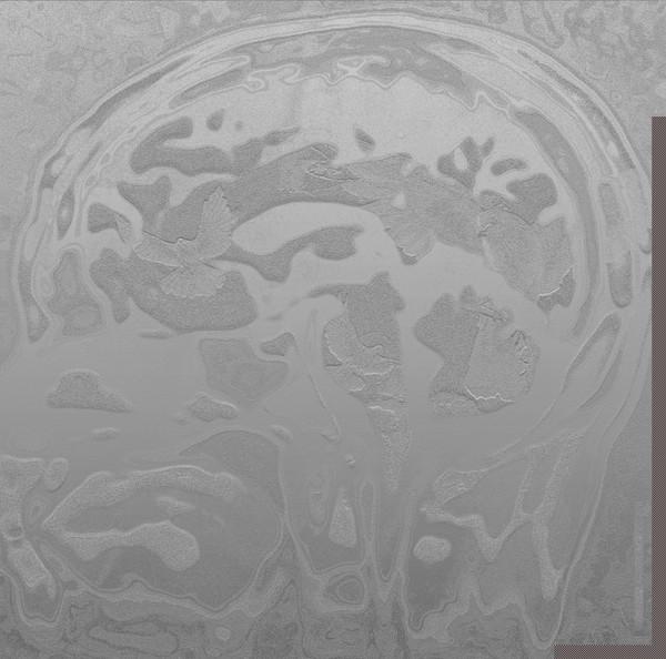 Contrast EP - Plebeian