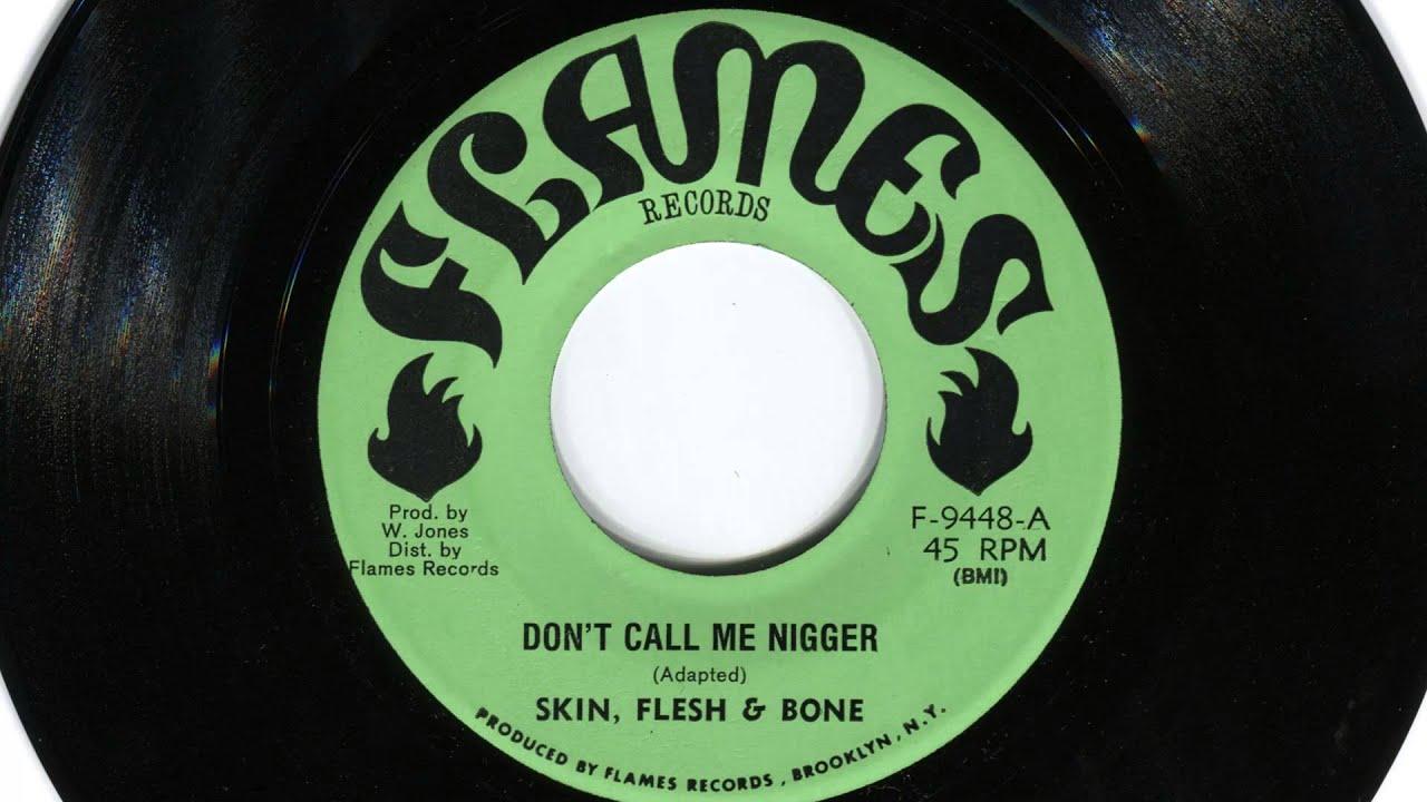 Don't Call Me Nigger - Skin, Flesh & Bones