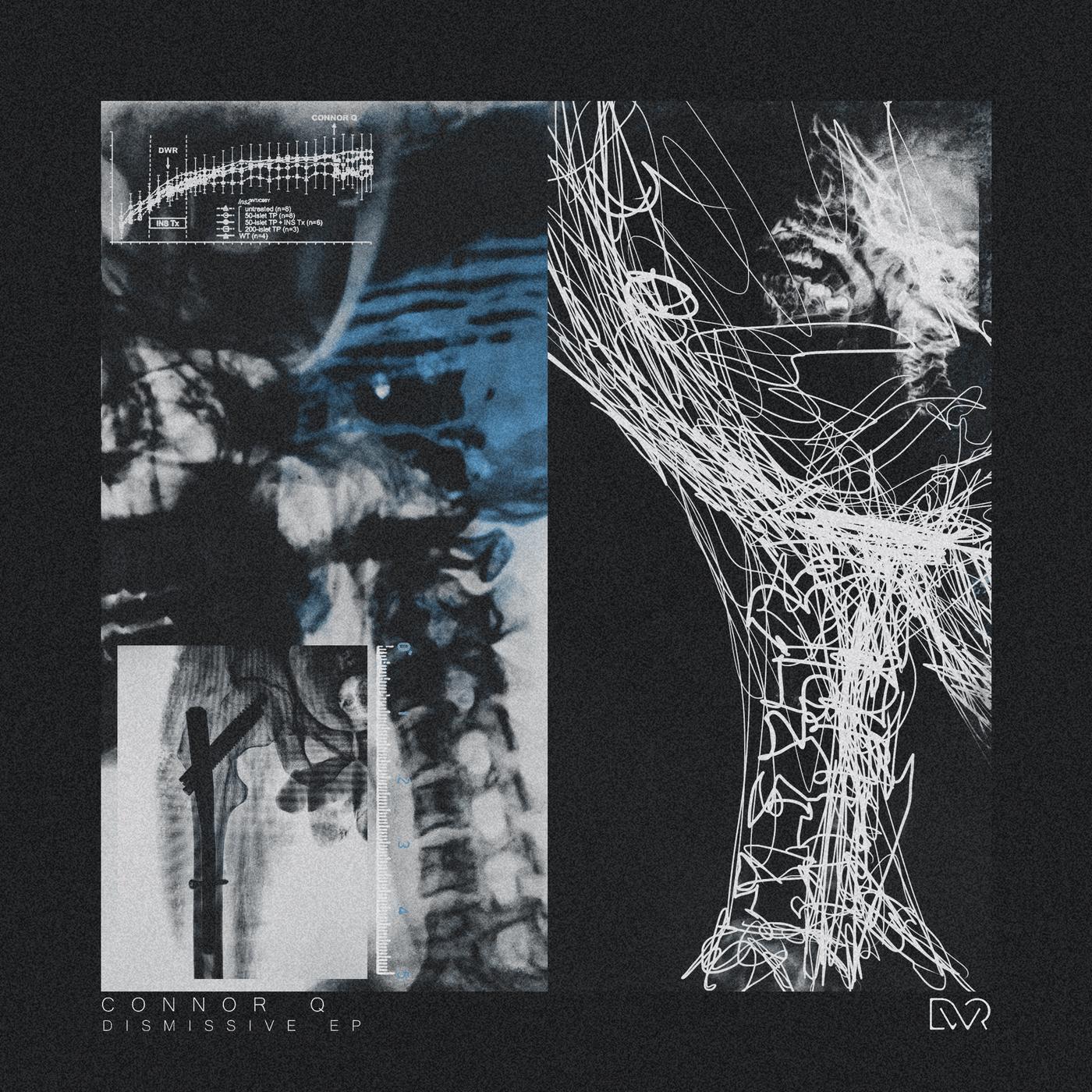 Dismissive EP - Connor q