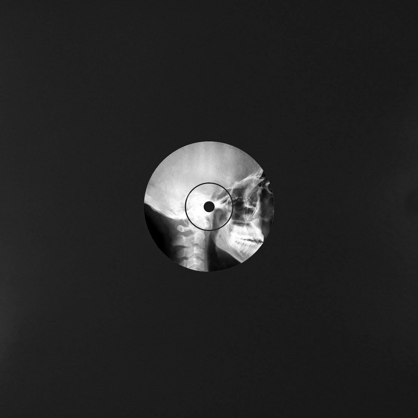 [A-01] - Anshaw Black