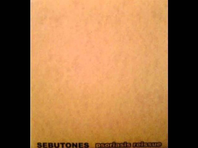  - Sebutones