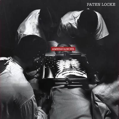 Americancer (Explicit) - Paten Locke