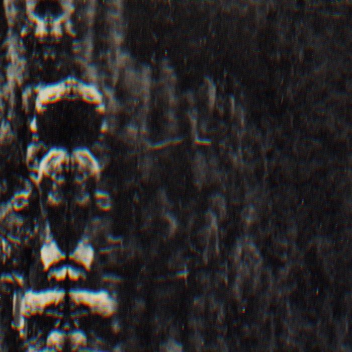 The Forest, the People and the Spirits - O Morto